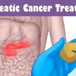 Pancreatic Cancer Treatment Market